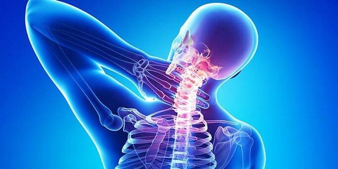 Příčiny osteochondrosy