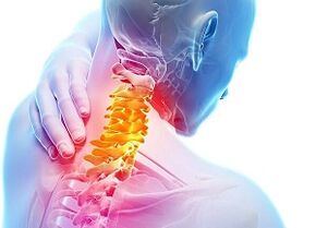 příčiny osteochondózy děložního čípku